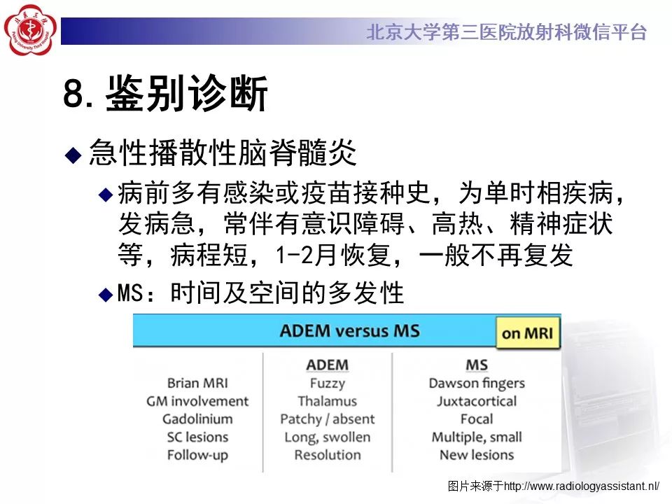 影像PPT - 【PPT】多发性硬化的影像-50