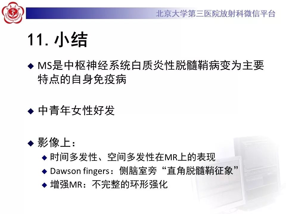 影像PPT - 【PPT】多发性硬化的影像-56