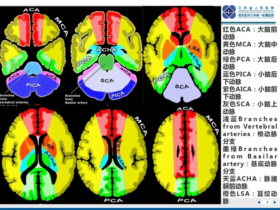 影像PPT - 【PPT】颈动脉蹼-11