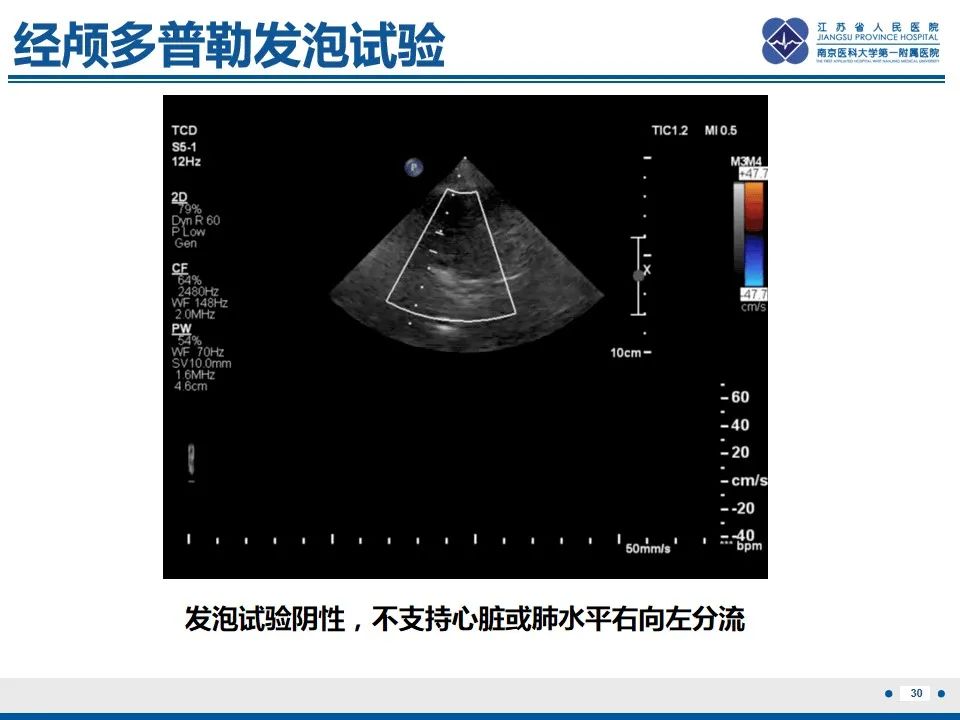 影像PPT - 【PPT】颈动脉蹼-32