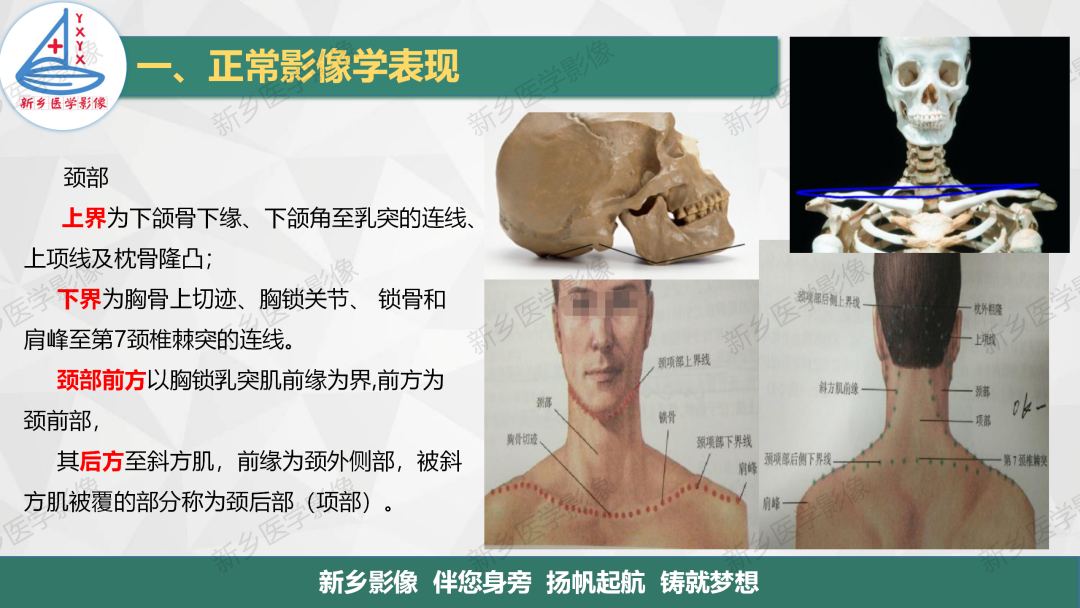 影像PPT - 【PPT】医学影像诊断学教材解读—颈部疾病2-3