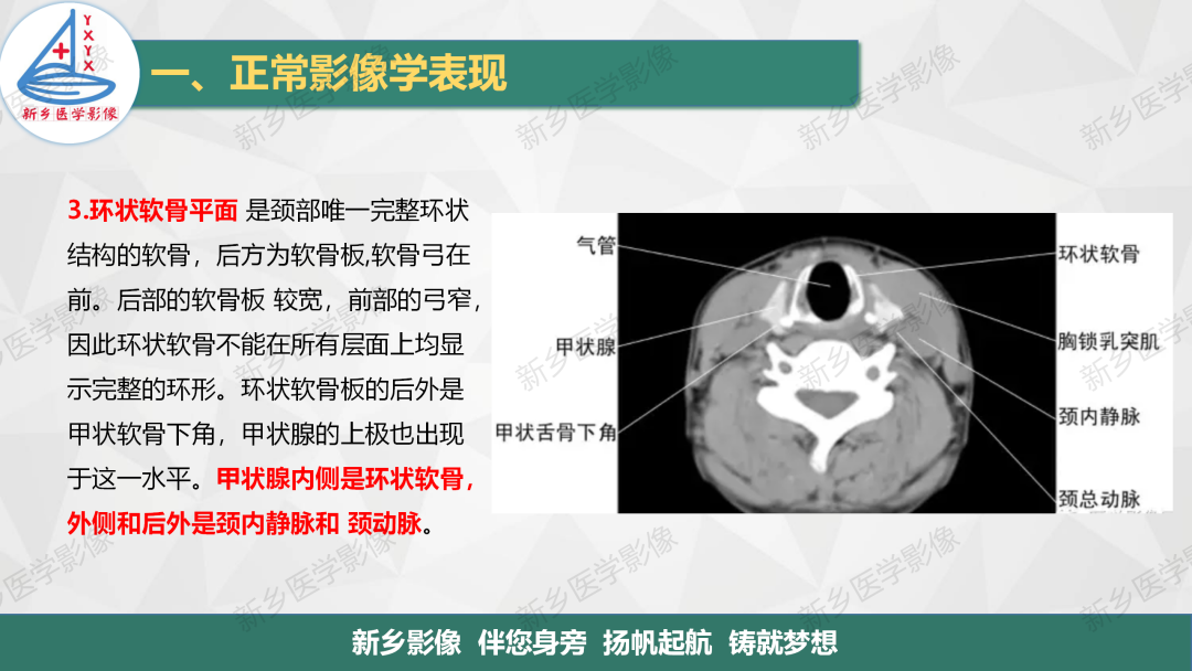 影像PPT - 【PPT】医学影像诊断学教材解读—颈部疾病2-6