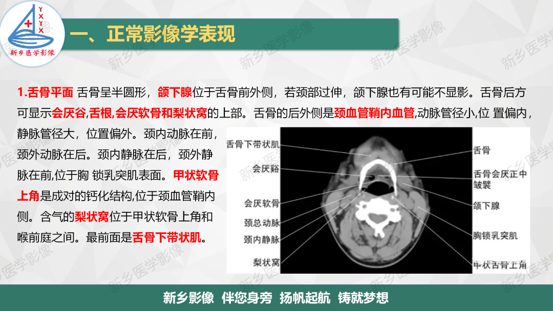 影像PPT - 【PPT】医学影像诊断学教材解读—颈部疾病2-4