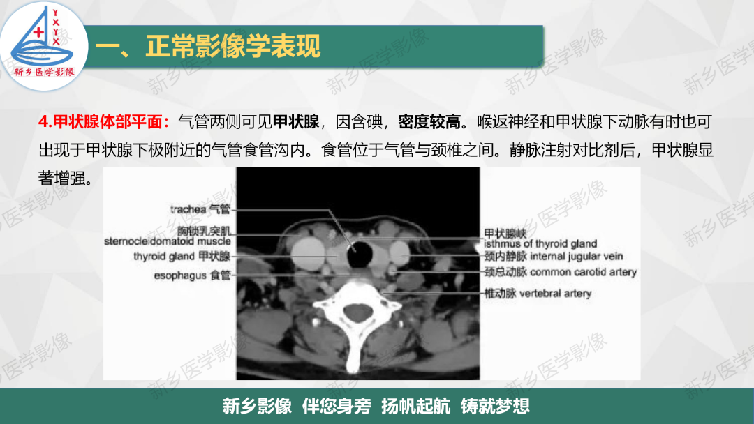 影像PPT - 【PPT】医学影像诊断学教材解读—颈部疾病2-7