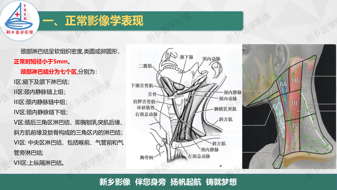 影像PPT - 【PPT】医学影像诊断学教材解读—颈部疾病2-9