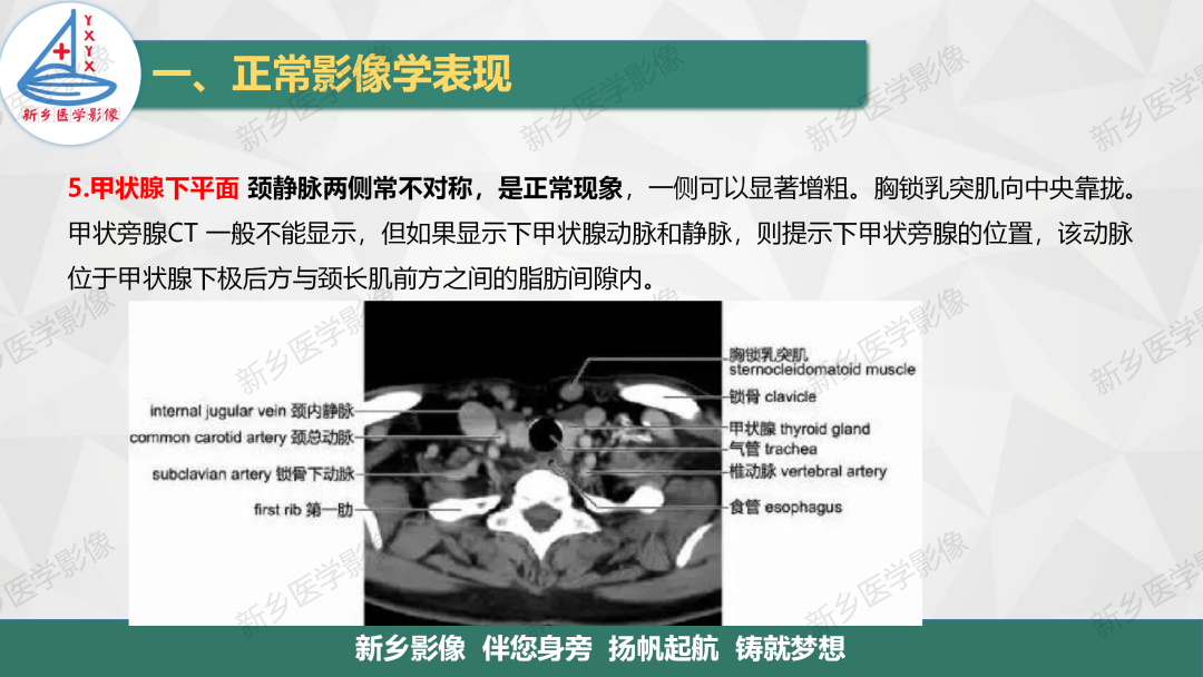 影像PPT - 【PPT】医学影像诊断学教材解读—颈部疾病2-8