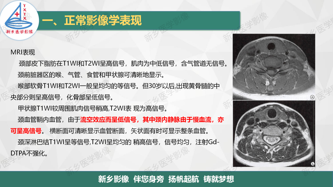 影像PPT - 【PPT】医学影像诊断学教材解读—颈部疾病2-14