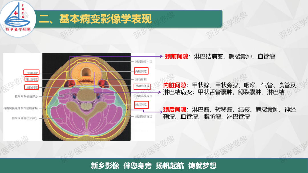影像PPT - 【PPT】医学影像诊断学教材解读—颈部疾病2-16