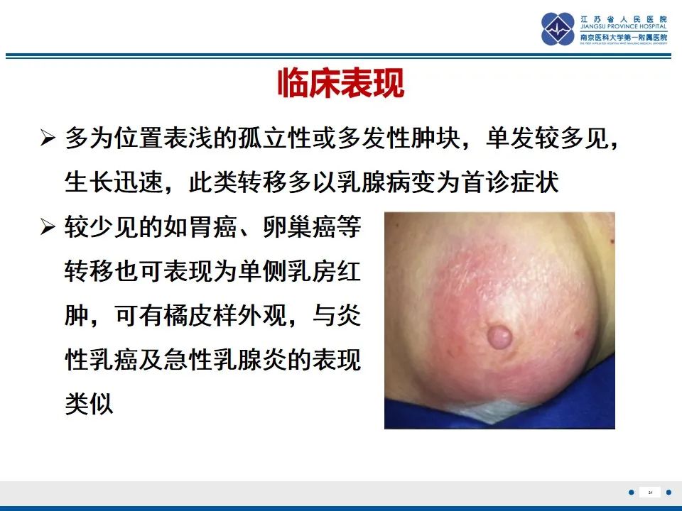 影像PPT - 【PPT】乳腺转移瘤-25
