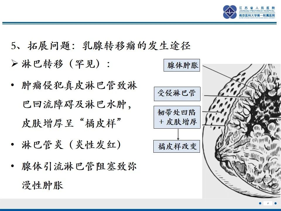 影像PPT - 【PPT】乳腺转移瘤-28