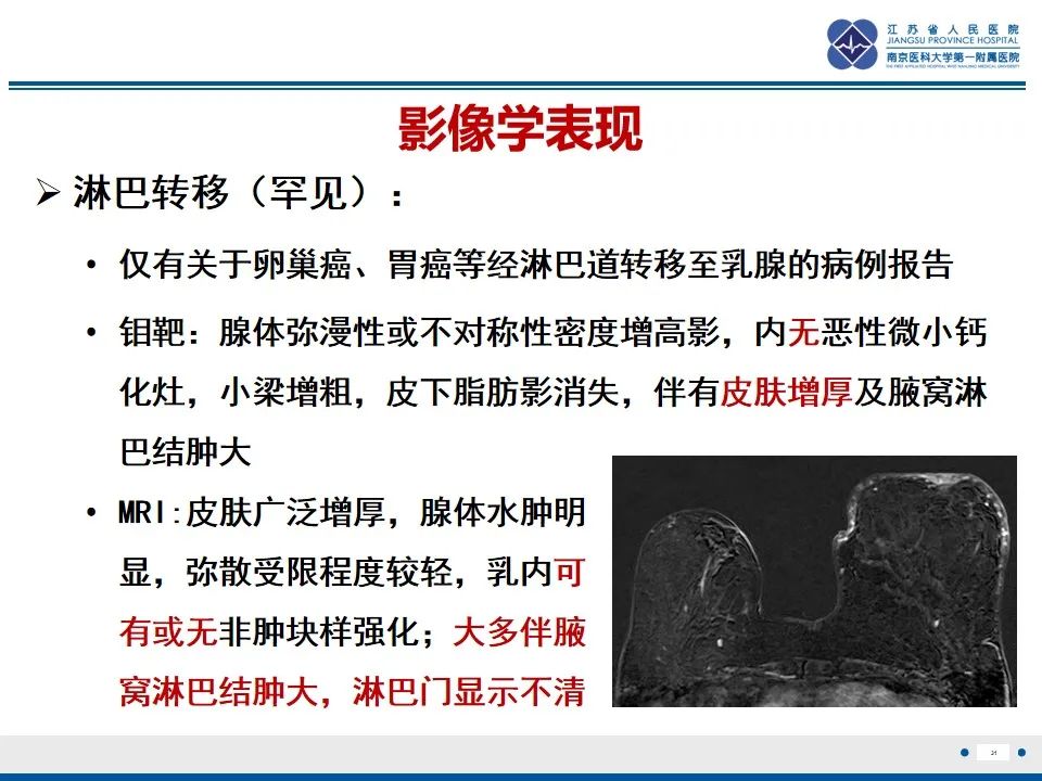 影像PPT - 【PPT】乳腺转移瘤-32