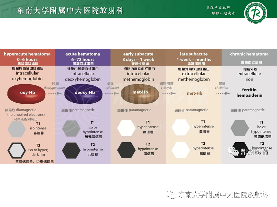 影像PPT - 【PPT】颅内海绵状血管瘤-10
