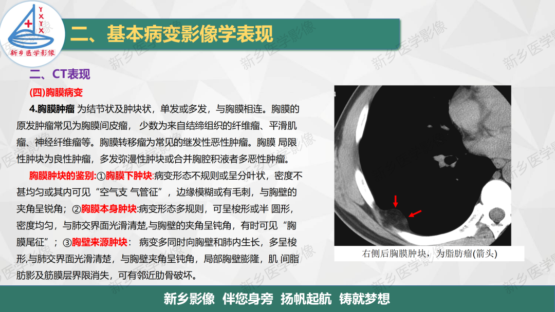 影像PPT - 【PPT】医学影像诊断学教材解读—胸部CT基本病变影像表现-21