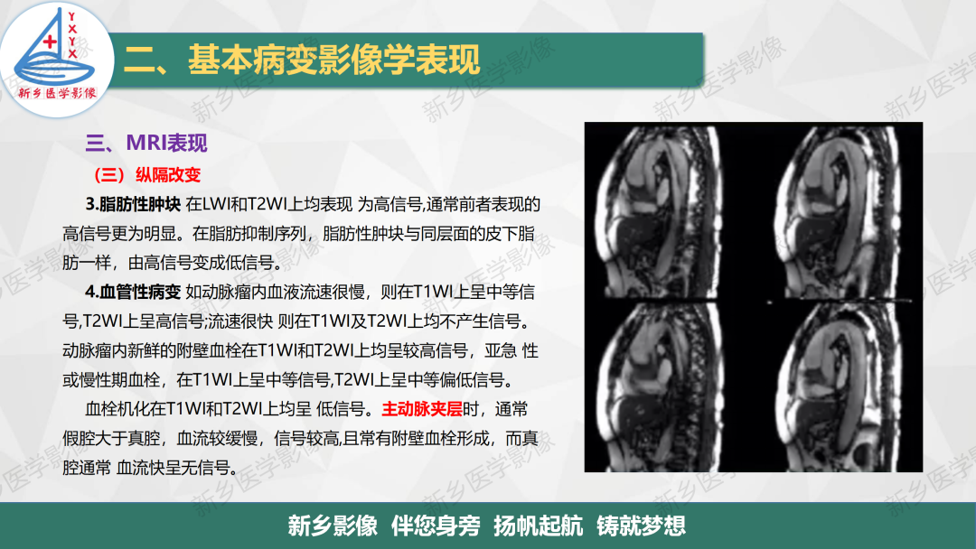 影像PPT - 【PPT】医学影像诊断学教材解读—胸部CT基本病变影像表现-27