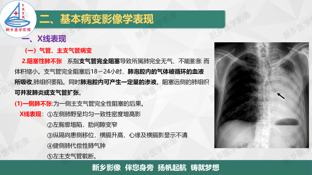 影像PPT - 【PPT】医学影像诊断学教材解读—胸部CT基本病变影像表现1-5
