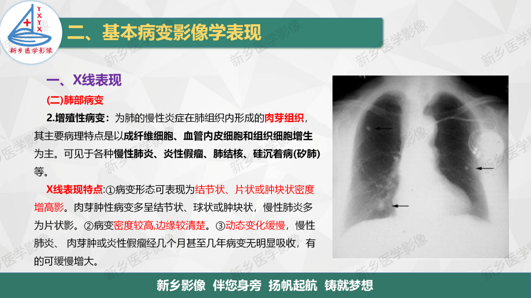 影像PPT - 【PPT】医学影像诊断学教材解读—胸部CT基本病变影像表现1-9
