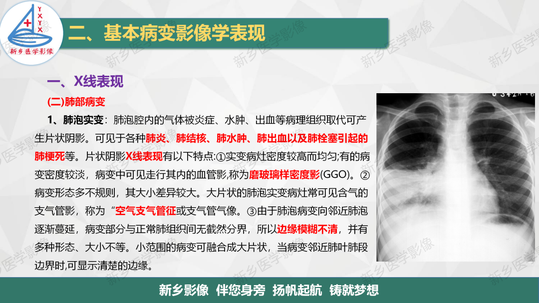 影像PPT - 【PPT】医学影像诊断学教材解读—胸部CT基本病变影像表现1-8