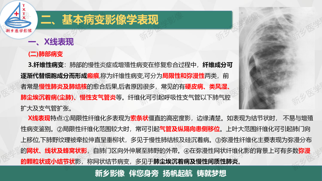 影像PPT - 【PPT】医学影像诊断学教材解读—胸部CT基本病变影像表现1-10