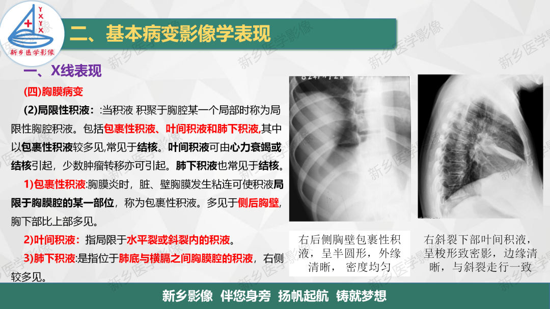 影像PPT - 【PPT】医学影像诊断学教材解读—胸部CT基本病变影像表现1-20