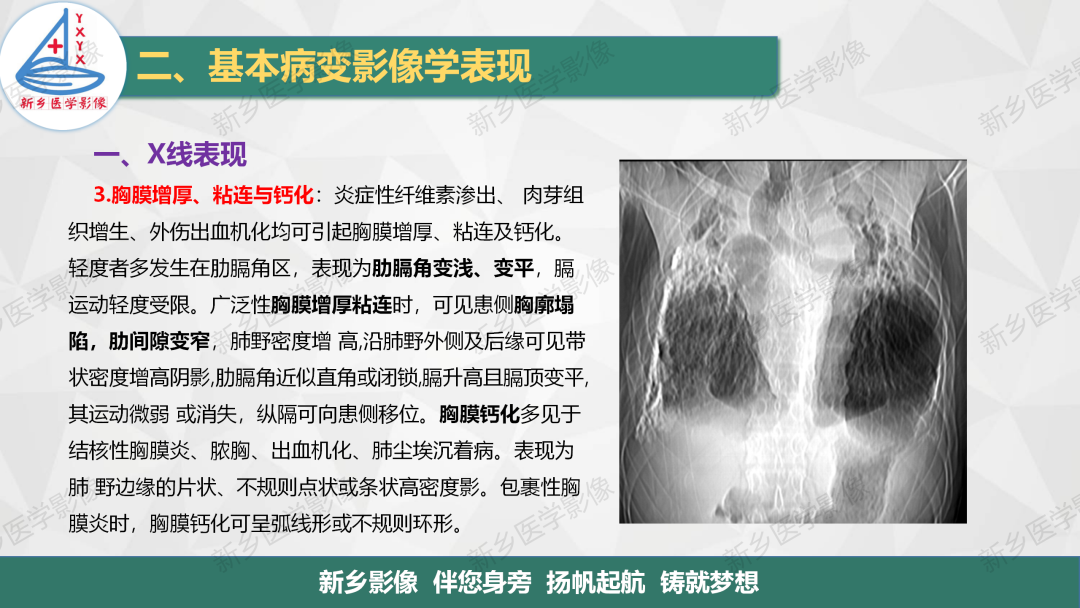 影像PPT - 【PPT】医学影像诊断学教材解读—胸部CT基本病变影像表现1-24