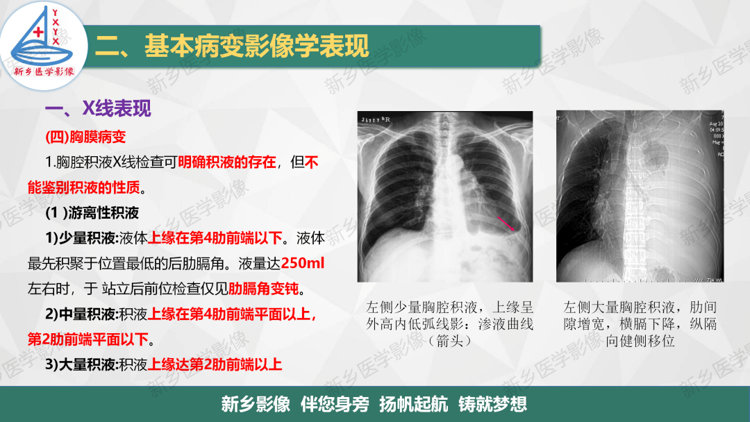 影像PPT - 【PPT】医学影像诊断学教材解读—胸部CT基本病变影像表现1-19