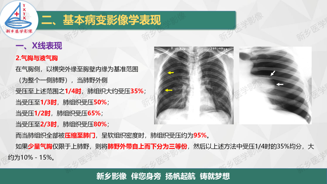 影像PPT - 【PPT】医学影像诊断学教材解读—胸部CT基本病变影像表现1-22