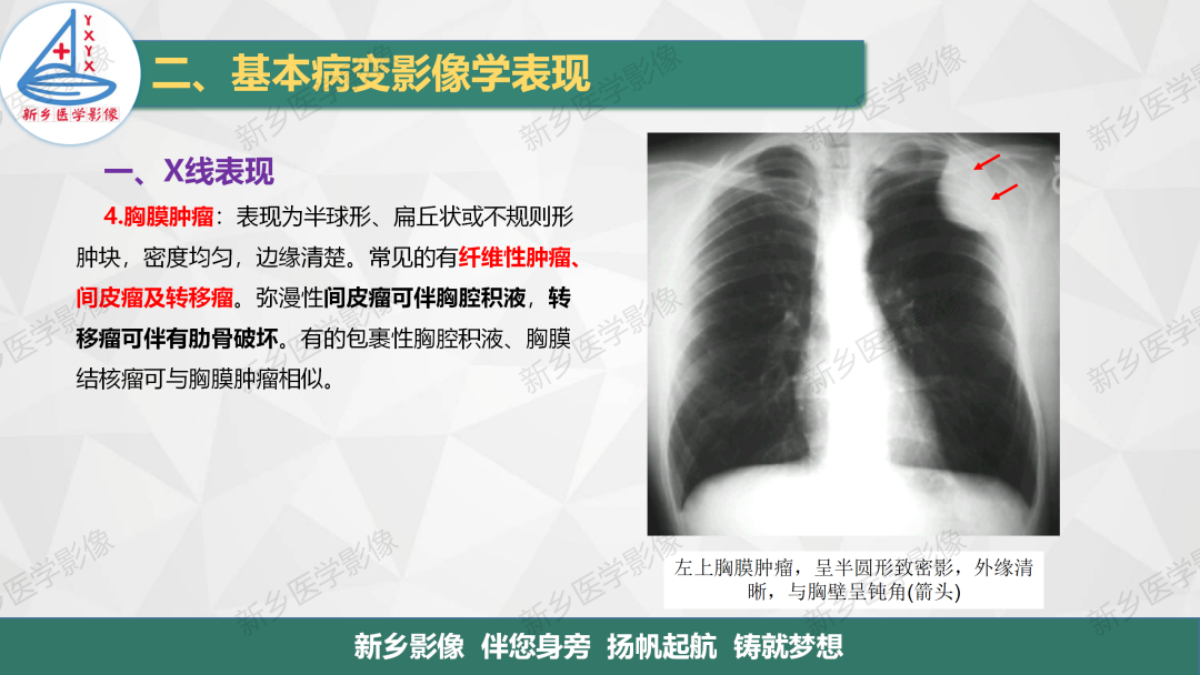 影像PPT - 【PPT】医学影像诊断学教材解读—胸部CT基本病变影像表现1-25