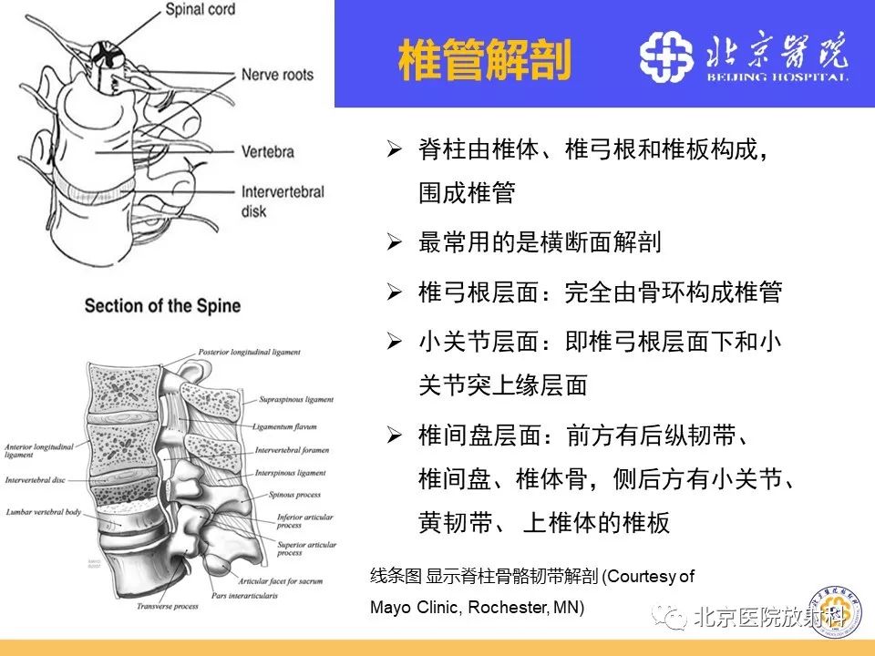 影像PPT - 【PPT】椎管狭窄的影像学检查-7