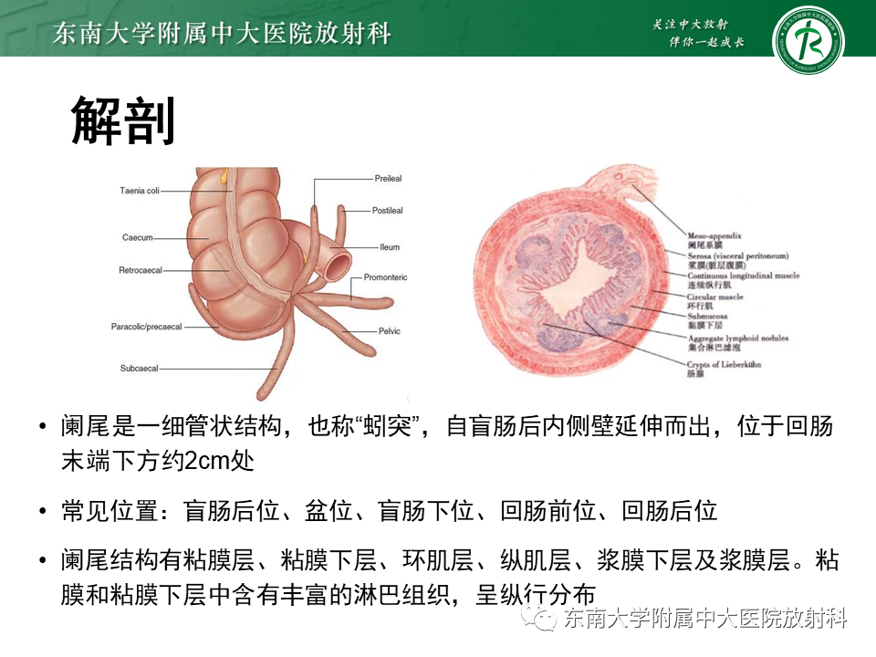影像PPT - 【PPT】阑尾黏液性肿瘤-4