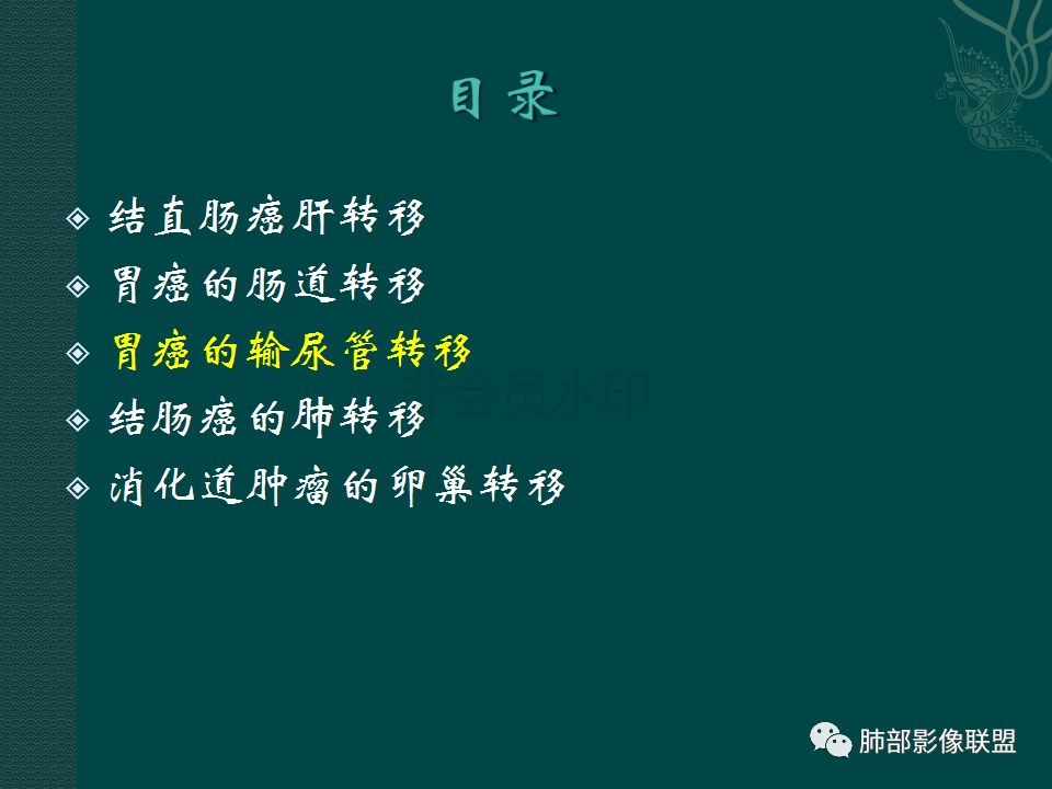 影像PPT - 【PPT】胃肠道肿瘤特征性影像浅析-35 影像PPT - 【PPT】胃肠道肿瘤特征性影像浅析-35