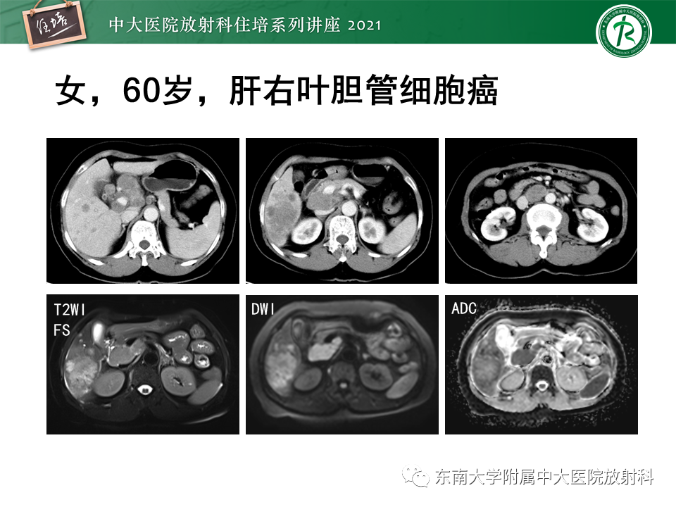 影像PPT - 【PPT】腹部淋巴结分区及影像分析-2