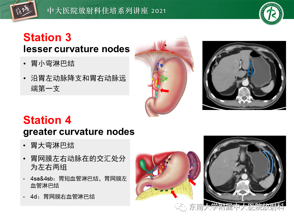 影像PPT - 【PPT】腹部淋巴结分区及影像分析-16