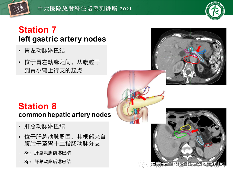 影像PPT - 【PPT】腹部淋巴结分区及影像分析-18