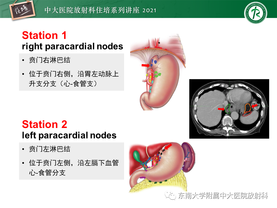 影像PPT - 【PPT】腹部淋巴结分区及影像分析-15