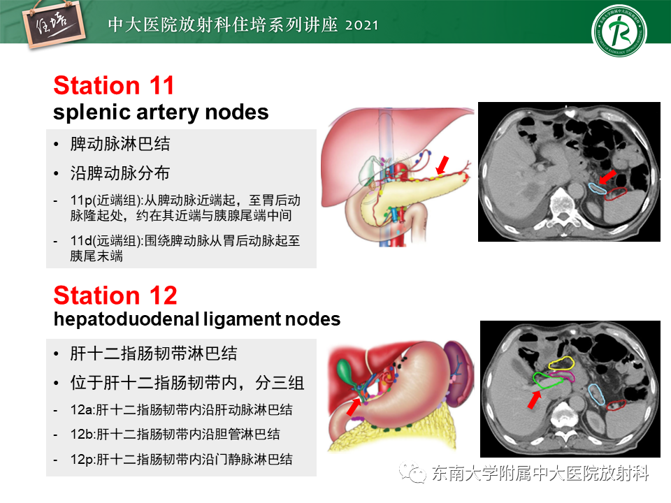 影像PPT - 【PPT】腹部淋巴结分区及影像分析-20