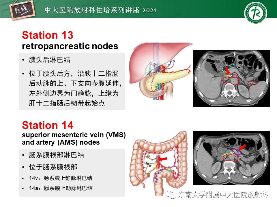 影像PPT - 【PPT】腹部淋巴结分区及影像分析-21