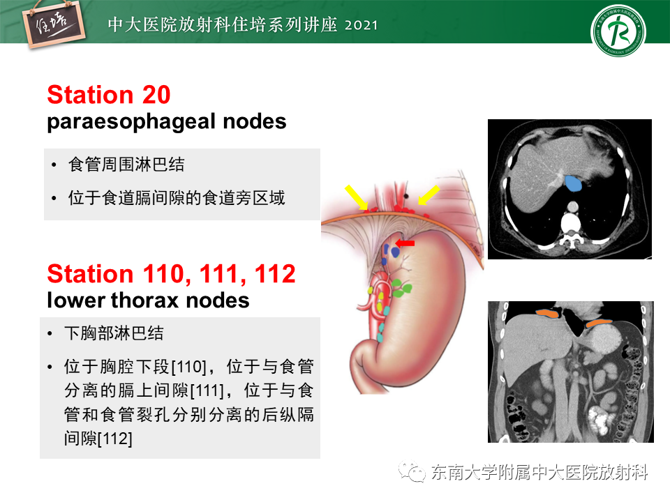 影像PPT - 【PPT】腹部淋巴结分区及影像分析-24
