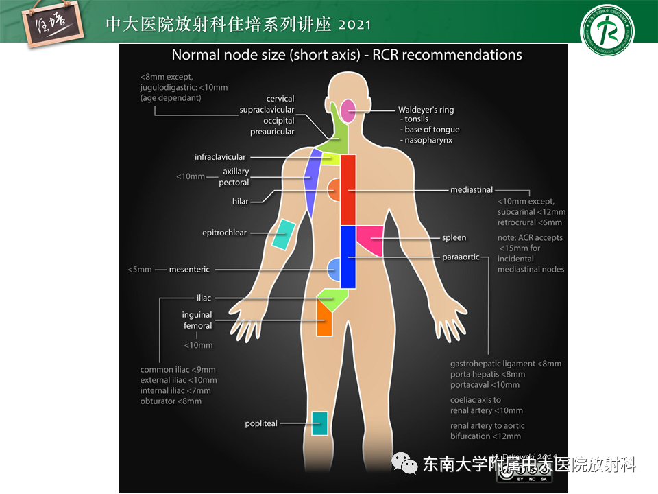 影像PPT - 【PPT】腹部淋巴结分区及影像分析-42