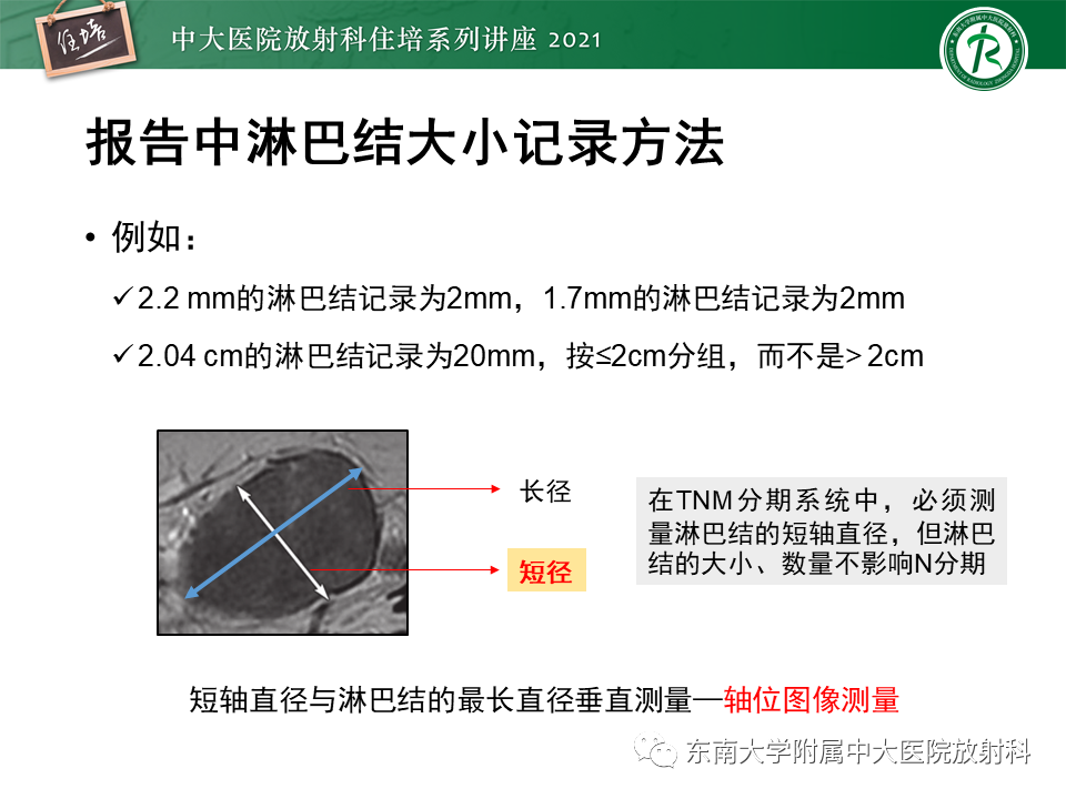 影像PPT - 【PPT】腹部淋巴结分区及影像分析-44