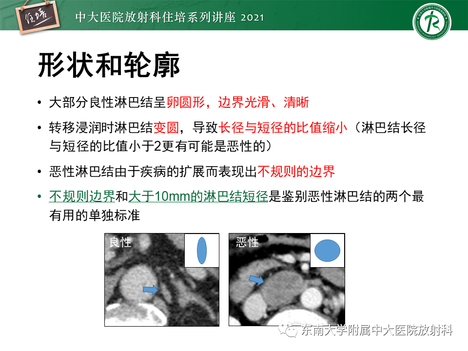 影像PPT - 【PPT】腹部淋巴结分区及影像分析-45