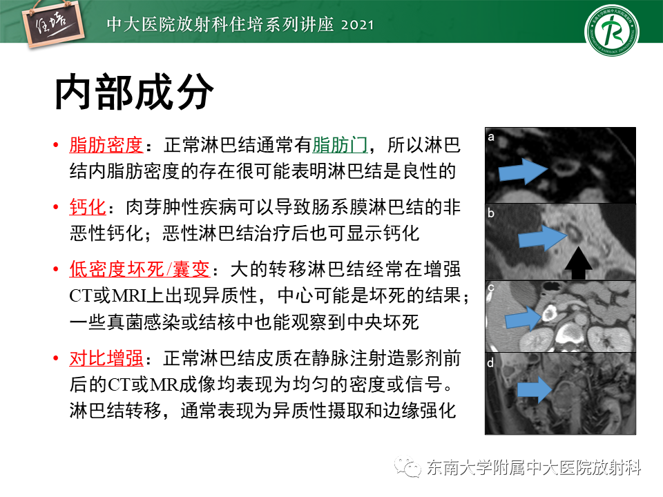 影像PPT - 【PPT】腹部淋巴结分区及影像分析-47