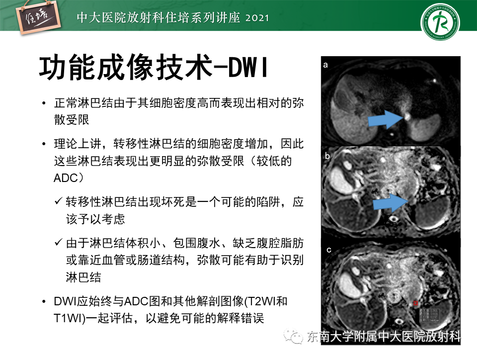 影像PPT - 【PPT】腹部淋巴结分区及影像分析-50