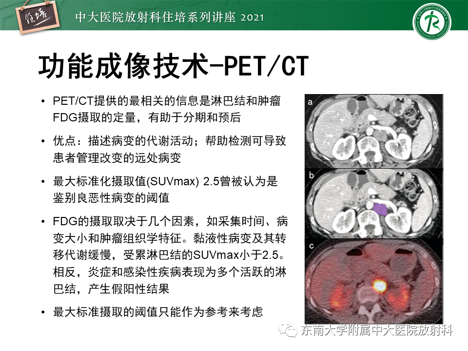 影像PPT - 【PPT】腹部淋巴结分区及影像分析-51