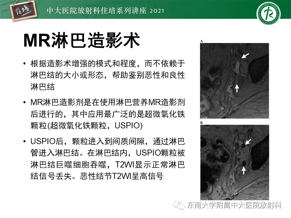 影像PPT - 【PPT】腹部淋巴结分区及影像分析-52
