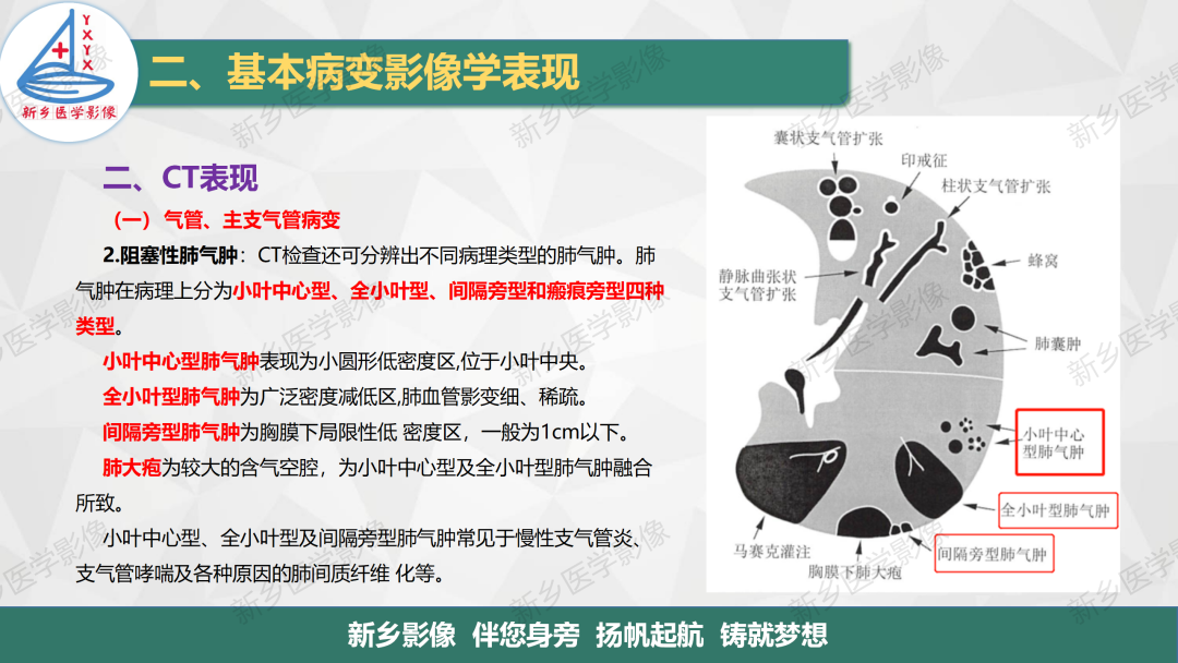 影像PPT - 【PPT】医学影像诊断学教材解读—呼吸基本病变影像表现3-3
