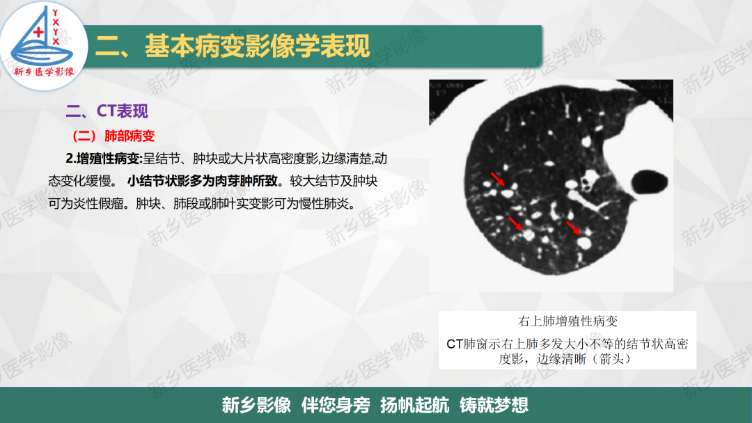 影像PPT - 【PPT】医学影像诊断学教材解读—呼吸基本病变影像表现3-6