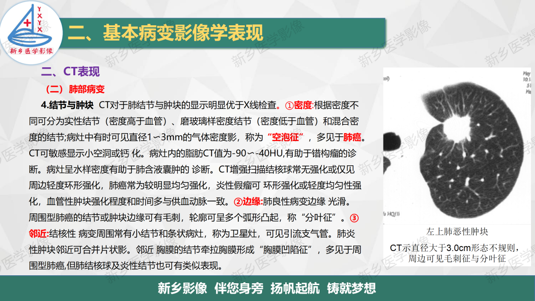 影像PPT - 【PPT】医学影像诊断学教材解读—呼吸基本病变影像表现3-8