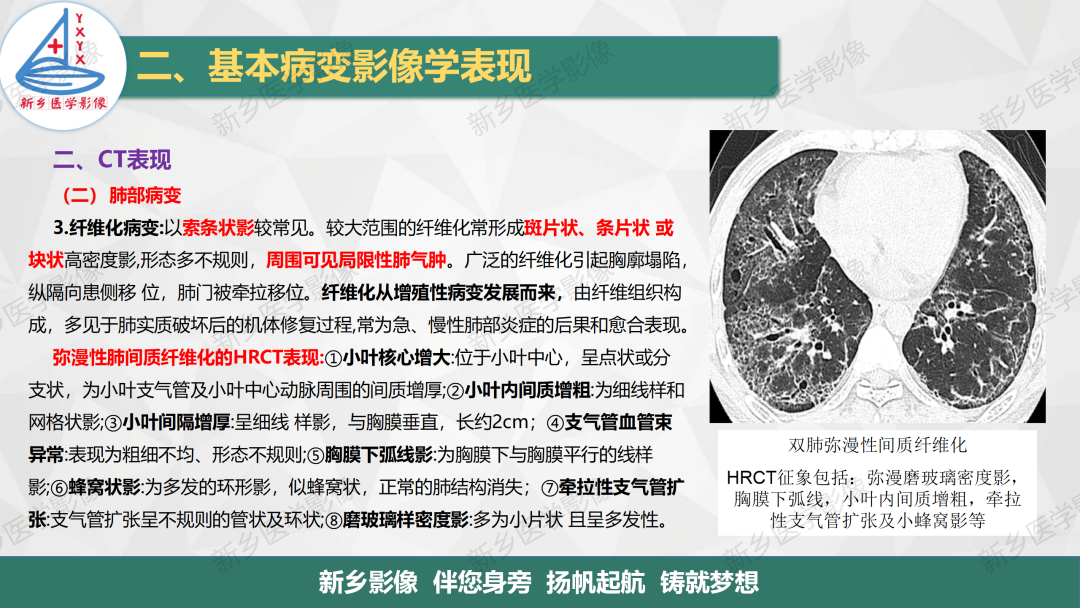 影像PPT - 【PPT】医学影像诊断学教材解读—呼吸基本病变影像表现3-7
