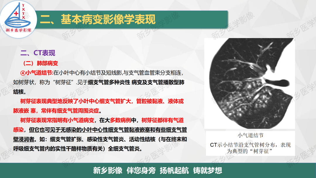 影像PPT - 【PPT】医学影像诊断学教材解读—呼吸基本病变影像表现3-13