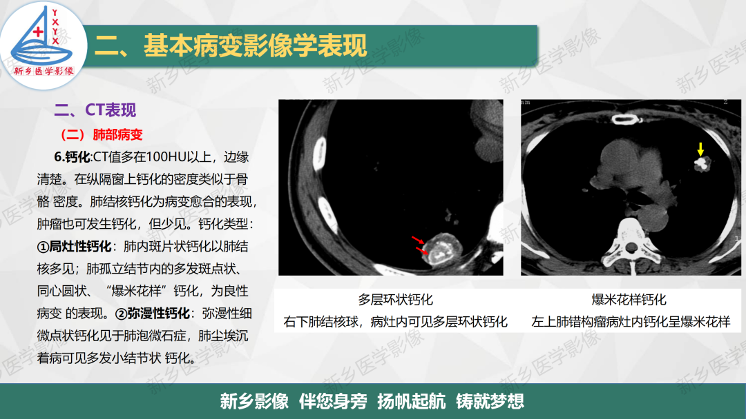 影像PPT - 【PPT】医学影像诊断学教材解读—呼吸基本病变影像表现3-16